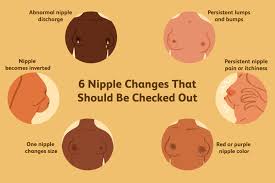 breast changes to look for abnormality