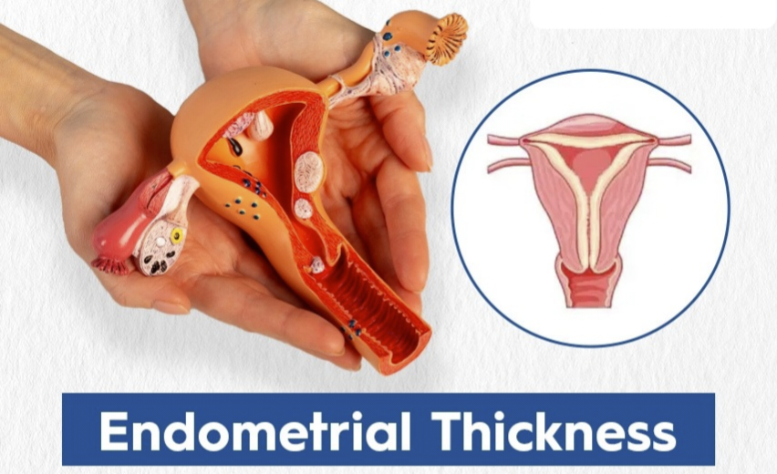Endometrial thickness management at advik homoeopathy clinic