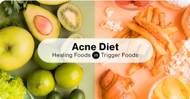 acne diet plan by dr greeva at advik homoeopathy clinic