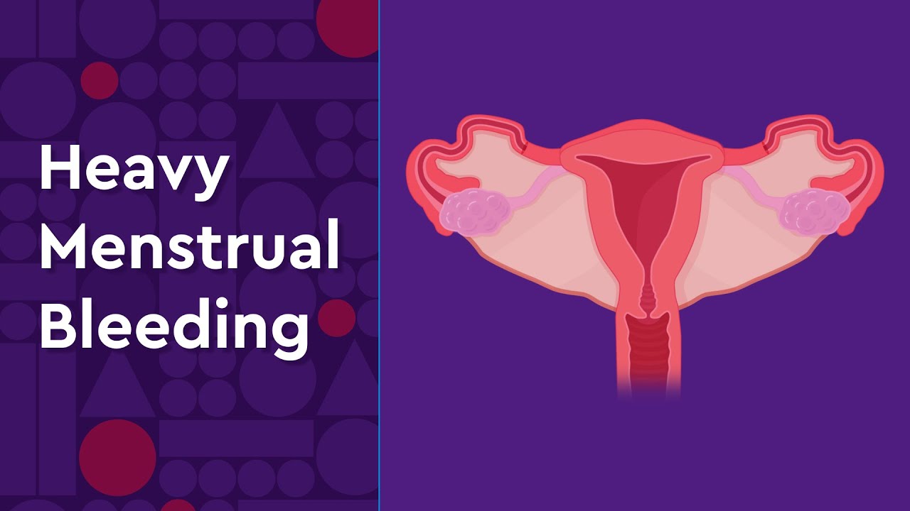 Heavy bleeding treatment at advik homoeopathy clinic