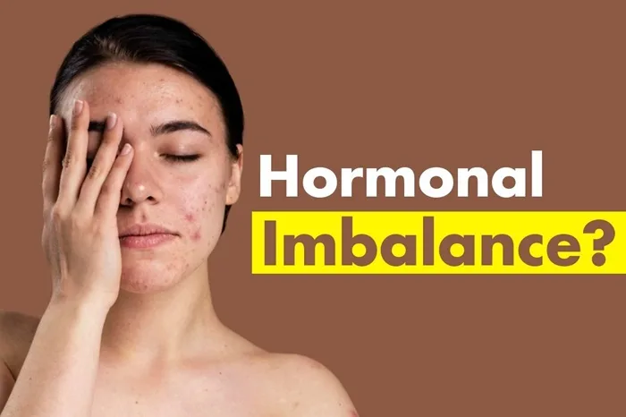 Hormonal imbalance self checklist made by dr greeva mankad at advik homoeopathy clinic
